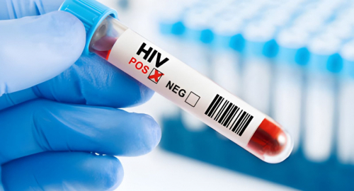 HIV, allarme UNAIDS: i finanziamenti ai minimi da vent'anni, a rischio milioni di vite